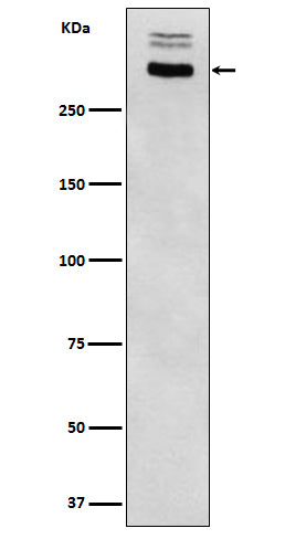 Anti-Thyroglobulin Rabbit Monoclonal Antibody Boster Bio