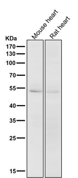 Anti-CD47 Rabbit Monoclonal Antibody Boster Bio