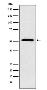 Anti-ETV6 Rabbit Monoclonal Antibody Boster Bio