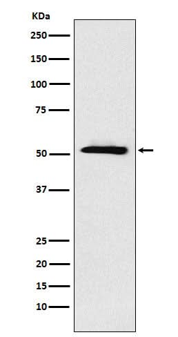 Anti-ETV6 Rabbit Monoclonal Antibody Boster Bio