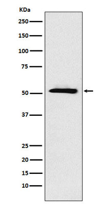 Anti-ETV6 Rabbit Monoclonal Antibody Boster Bio
