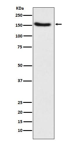Anti-Hamartin Rabbit Monoclonal Antibody Boster Bio