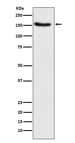 Anti-Hamartin Rabbit Monoclonal Antibody Boster Bio