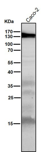 Anti-iNOS NOS2 Rabbit Monoclonal Antibody Boster Bio
