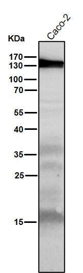 Anti-iNOS NOS2 Rabbit Monoclonal Antibody Boster Bio