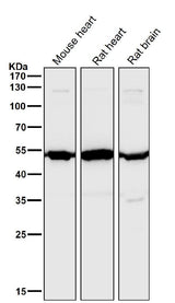 Anti-Angiopoietin 2 Rabbit Monoclonal Antibody Boster Bio