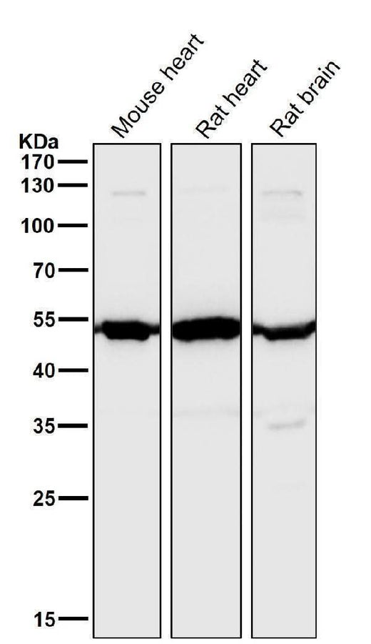 Anti-Angiopoietin 2 Rabbit Monoclonal Antibody Boster Bio