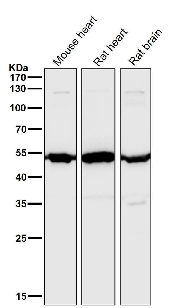 Anti-Angiopoietin 2 Rabbit Monoclonal Antibody Boster Bio