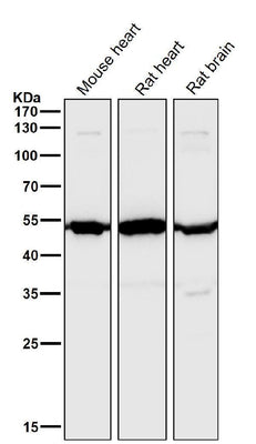Anti-Angiopoietin 2 Rabbit Monoclonal Antibody Boster Bio