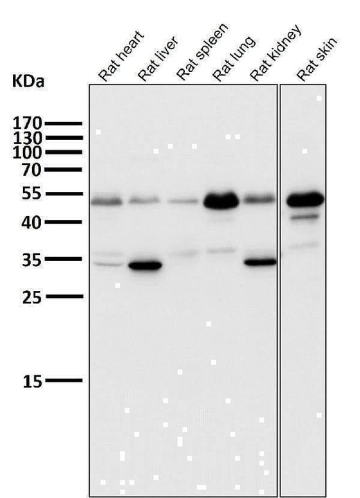 Anti-ATF4 Rabbit Monoclonal Antibody Boster Bio