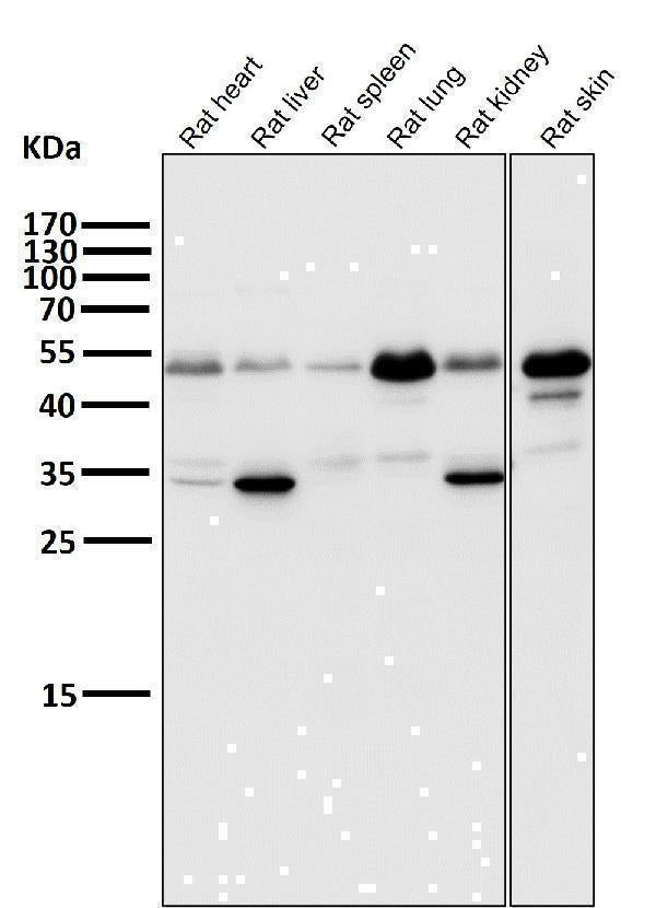 Anti-ATF4 Rabbit Monoclonal Antibody Boster Bio