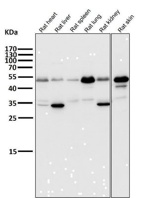 Anti-ATF4 Rabbit Monoclonal Antibody Boster Bio