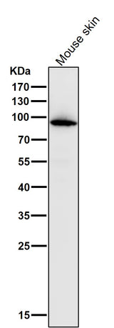 Anti-Myeloperoxidase Rabbit Monoclonal Antibody Boster Bio