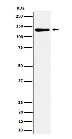 Anti-MCM2 Rabbit Monoclonal Antibody Boster Bio