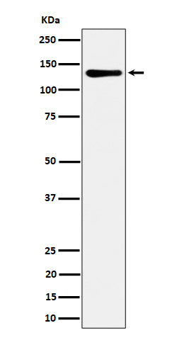 Anti-MCM2 Rabbit Monoclonal Antibody Boster Bio