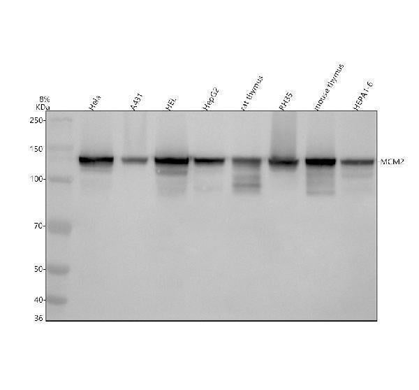 Anti-MCM2 Rabbit Monoclonal Antibody Boster Bio