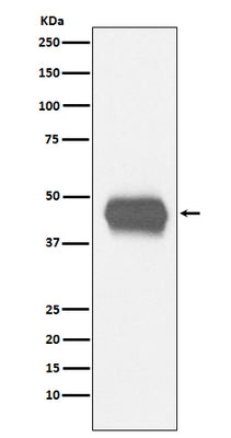 Anti-CD1a Rabbit Monoclonal Antibody Boster Bio