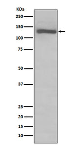 Anti-TLR7 Rabbit Monoclonal Antibody Boster Bio