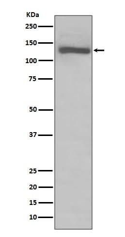 Anti-TLR7 Rabbit Monoclonal Antibody Boster Bio