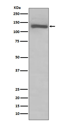 Anti-TLR7 Rabbit Monoclonal Antibody Boster Bio