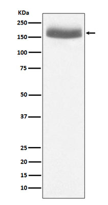 Anti-EGF Rabbit Monoclonal Antibody Boster Bio