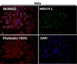 Anti-Survivin BIRC5 Rabbit Monoclonal Antibody Boster Bio