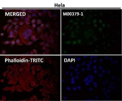 Anti-Survivin BIRC5 Rabbit Monoclonal Antibody Boster Bio