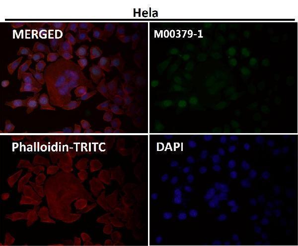 Anti-Survivin BIRC5 Rabbit Monoclonal Antibody Boster Bio