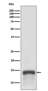 Anti-S100A9 Rabbit Monoclonal Antibody Boster Bio