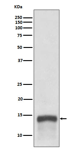 Anti-S100A9 Rabbit Monoclonal Antibody Boster Bio