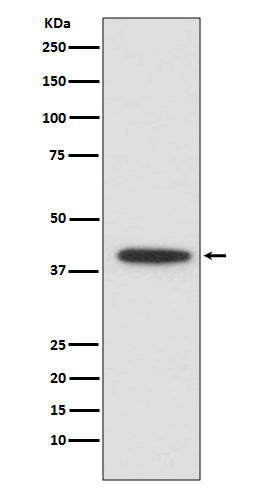 Anti-CEBP alpha Rabbit Monoclonal Antibody Boster Bio