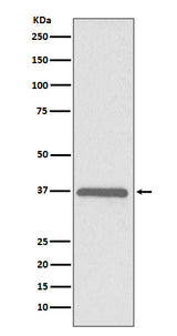 Anti-ERCC1 Rabbit Monoclonal Antibody Boster Bio