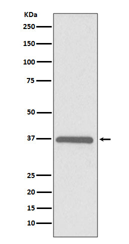 Anti-ERCC1 Rabbit Monoclonal Antibody Boster Bio