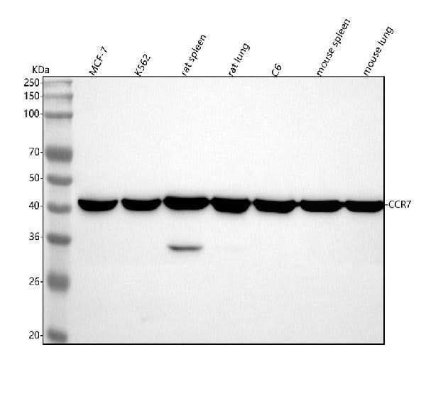 Anti-CCR7 Rabbit Monoclonal Antibody Boster Bio