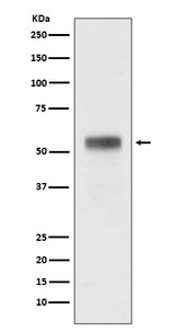 Anti-Retinoic Acid Receptor alpha RARA Rabbit Monoclonal Antibody Boster Bio