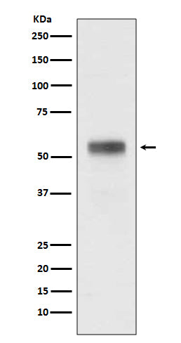 Anti-Retinoic Acid Receptor alpha RARA Rabbit Monoclonal Antibody Boster Bio