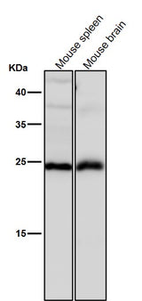 Anti-Interferon gamma IFNG Rabbit Monoclonal Antibody Boster Bio