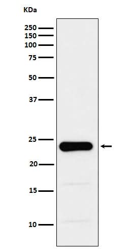 Anti-GST3 / GSTP1 Monoclonal Antibody Boster Bio