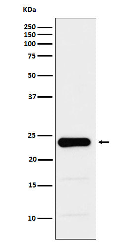 Anti-GST3 / GSTP1 Monoclonal Antibody Boster Bio