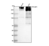 Anti-53BP1 TP53BP1 Rabbit Monoclonal Antibody Boster Bio