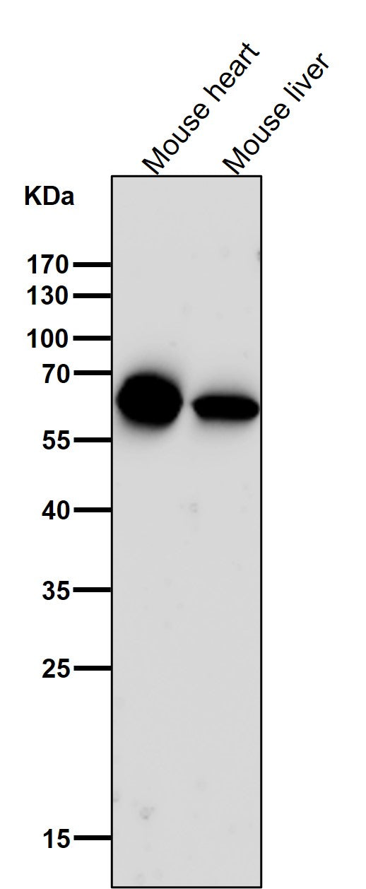 Anti-Cytokeratin 5 KRT5 Rabbit Monoclonal Antibody Boster Bio