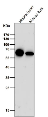 Anti-Cytokeratin 5 KRT5 Rabbit Monoclonal Antibody Boster Bio