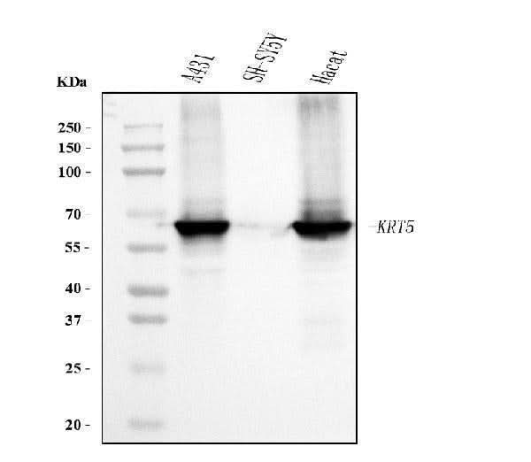 Anti-Cytokeratin 5 Antibody Picoband® (monoclonal, 5D3F7 Boster Bio