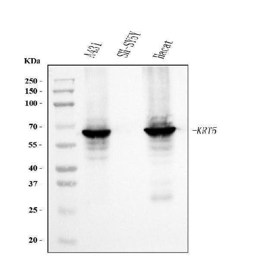 Anti-Cytokeratin 5 Antibody Picoband® (monoclonal, 9H2F8 Boster Bio