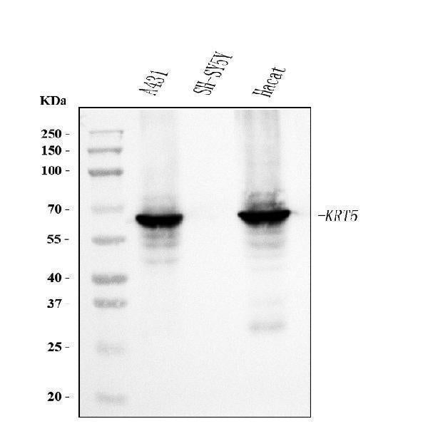 Anti-Cytokeratin 5 Antibody Picoband® (monoclonal, 9H2F8 Boster Bio