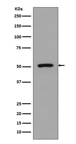 Anti-FLI1 Rabbit Monoclonal Antibody Boster Bio
