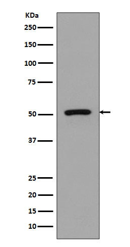 Anti-FLI1 Rabbit Monoclonal Antibody Boster Bio