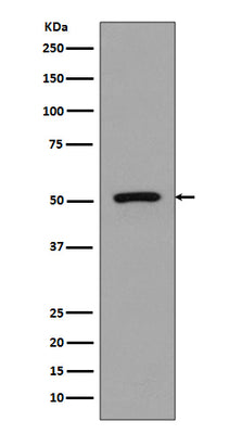 Anti-FLI1 Rabbit Monoclonal Antibody Boster Bio