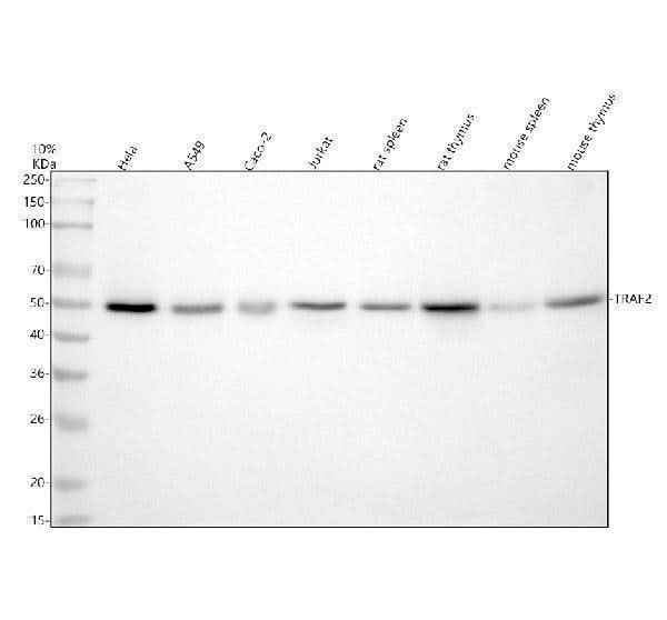 Anti-TRAF2 Rabbit Monoclonal Antibody Boster Bio