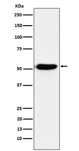 Anti-IRF4 Rabbit Monoclonal Antibody Boster Bio